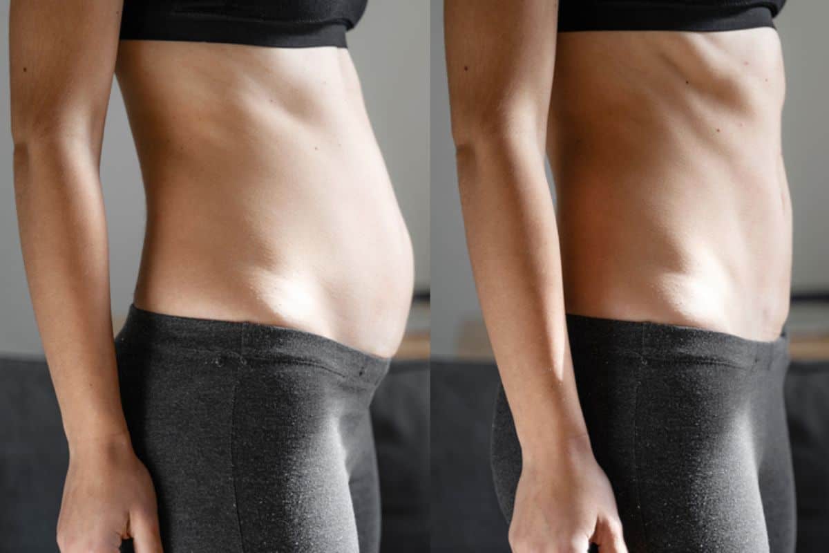 Post-Pregnancy: What Happens to Your Abdominal Muscles After Birth Greater London (Waltham Forest)