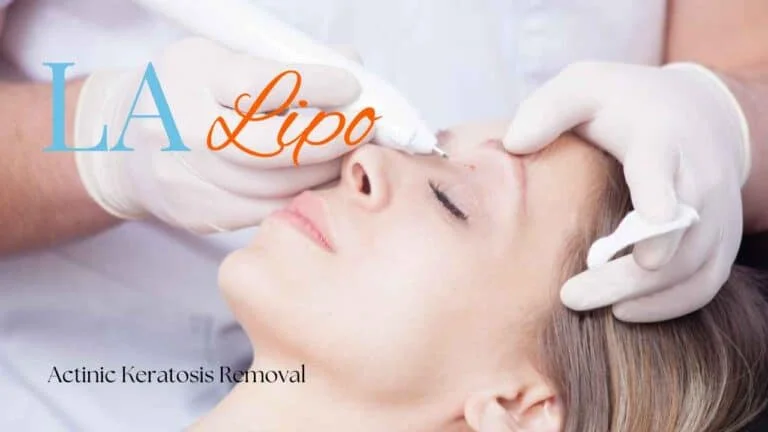 Woman receiving Actinic Keratosis Removal Treatment Greater London (Waltham Forest)