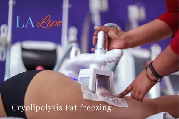 women getting fat freezing Greater London (Waltham Forest)