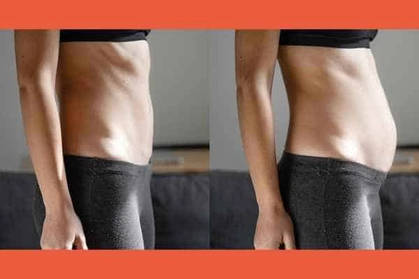 LA-EMS Body Sculpting results Greater London (Waltham Forest)