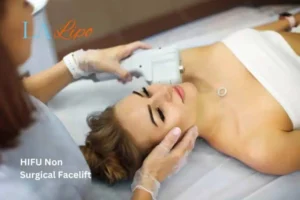 Woman having Hi-Fu to reduce wrinkles Greater London (Waltham Forest).