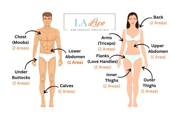 LA LIPO Cryolipolysis Areas Greater London (Waltham Forest)