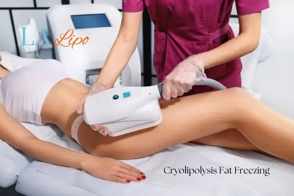 Woman receiving coolsculpting Greater London (Waltham Forest) treatment on her thighs