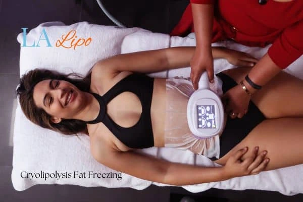 woman getting cryolipolysis Greater London (Waltham Forest)