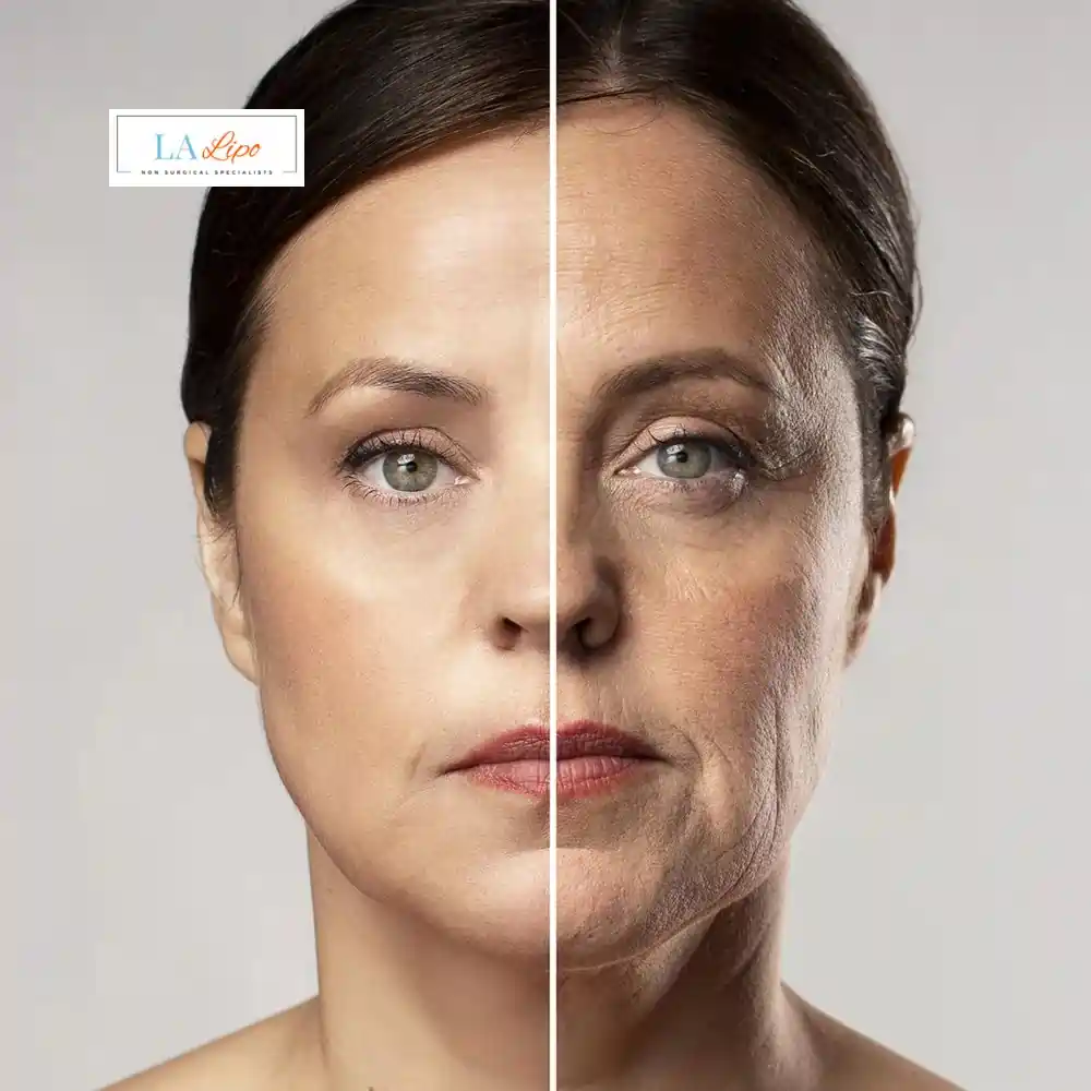How Can You Tell If Non-Surgical Skin Tightening Is Right for You Greater London (Waltham Forest)?