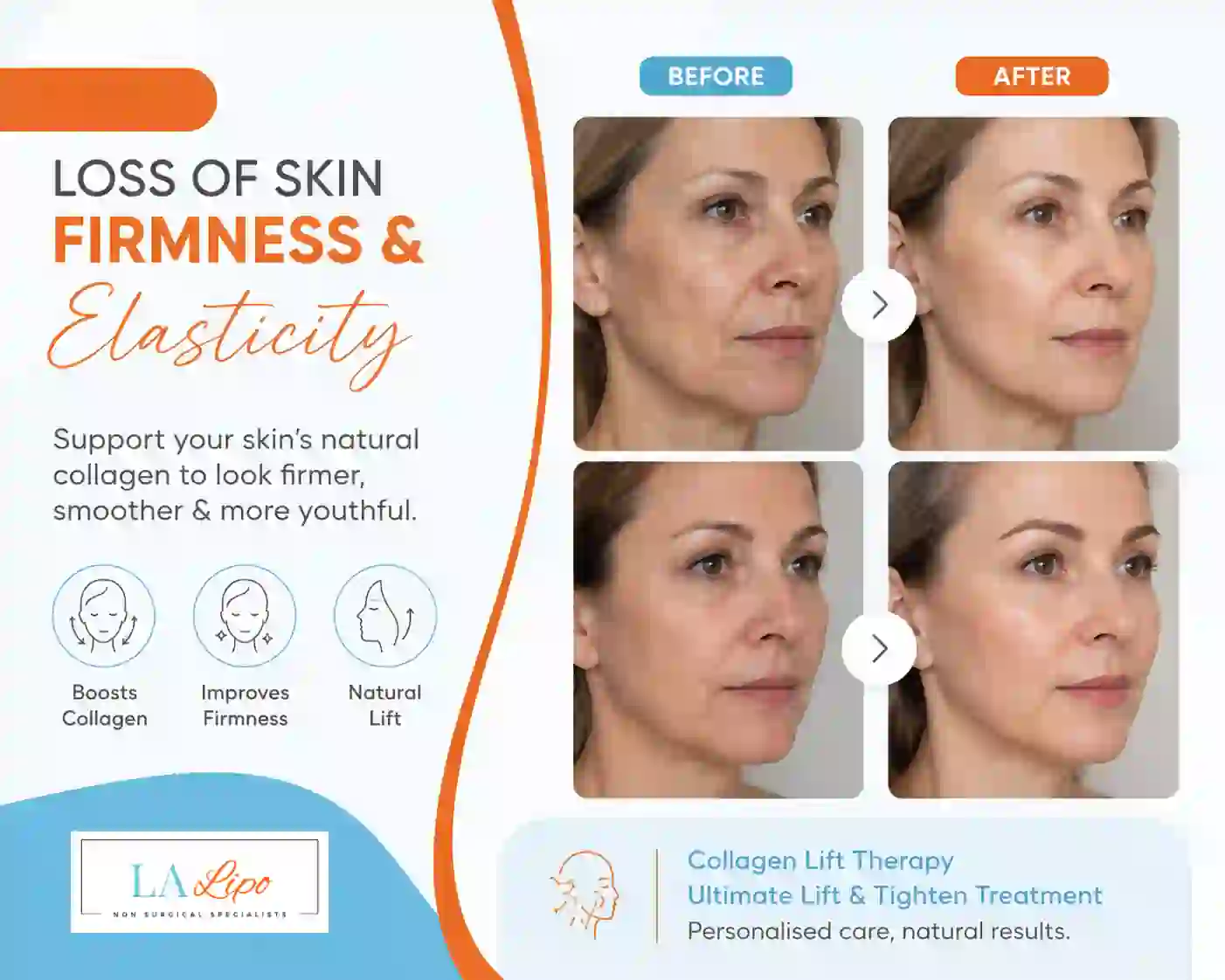 Sign #7: Loss of Skin Firmness and Elasticity Greater London (Waltham Forest)